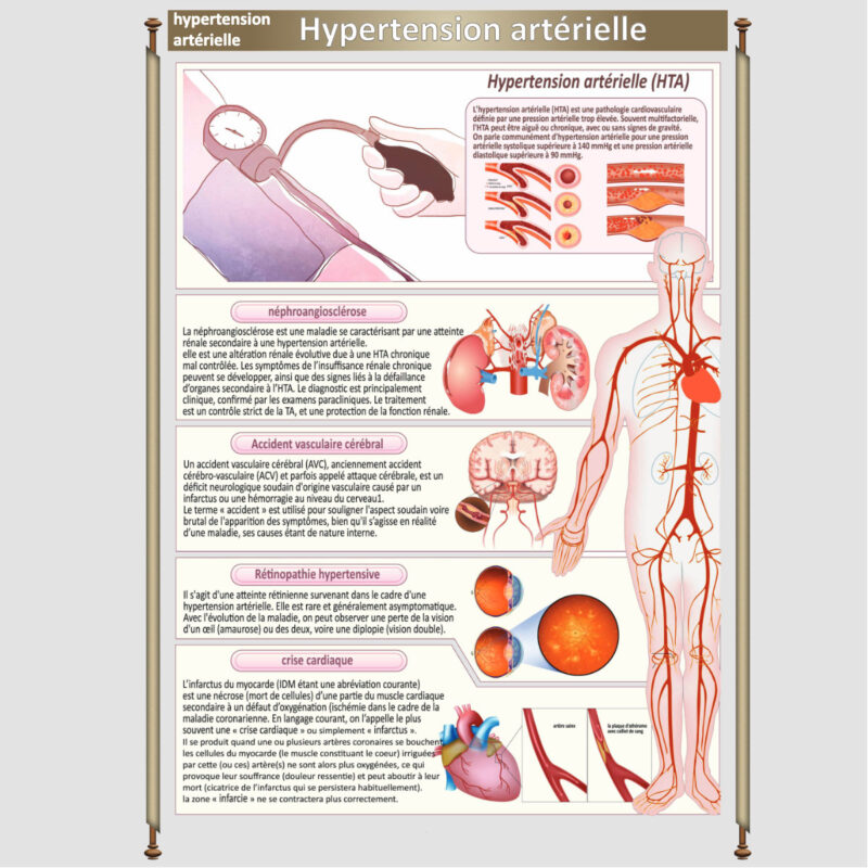 hypertension arterielle